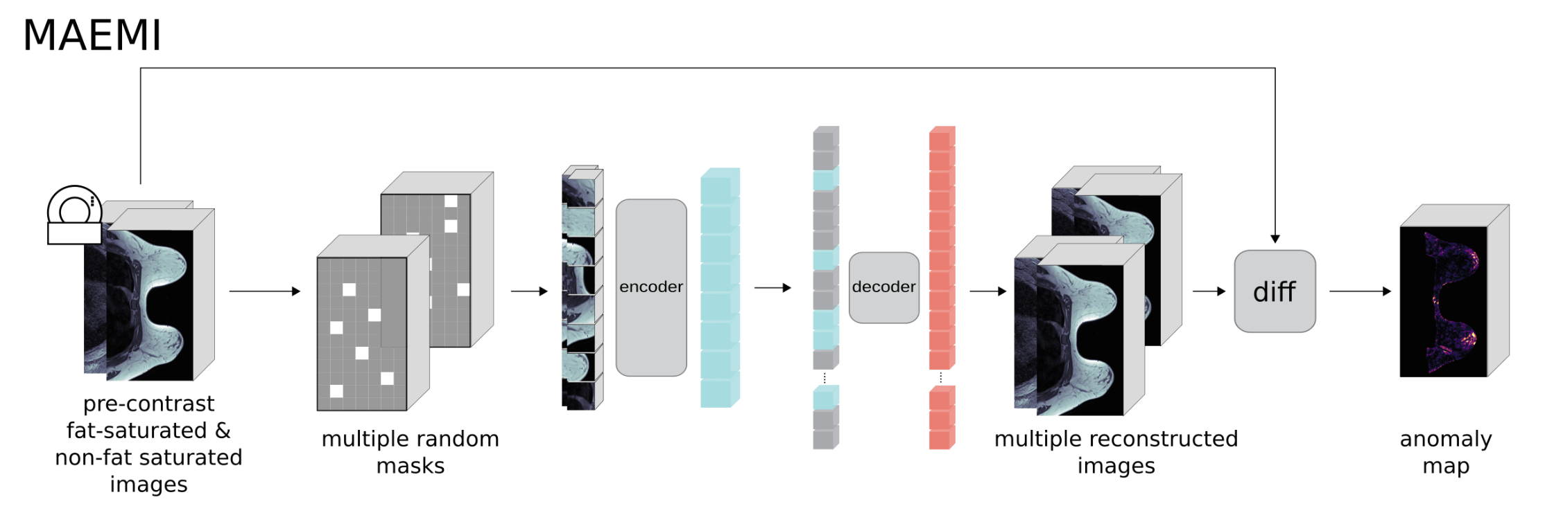 Multispectral 3D masked autoencoders for anomaly detection in non-contrast enhanced breast MRI